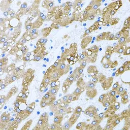 Anti-TOB2 antibody used in IHC (Paraffin sections) (IHC-P). GTX65957