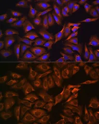 Anti-GPIP137 antibody used in Immunocytochemistry/ Immunofluorescence (ICC/IF). GTX65964