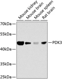 Anti-PDK3 antibody used in Western Blot (WB). GTX65965