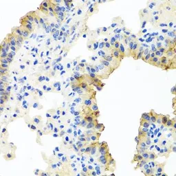 Anti-Ferrochelatase antibody used in IHC (Paraffin sections) (IHC-P). GTX65973