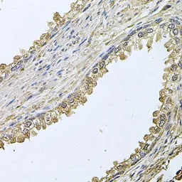 Anti-MEMO1 antibody used in IHC (Paraffin sections) (IHC-P). GTX65986