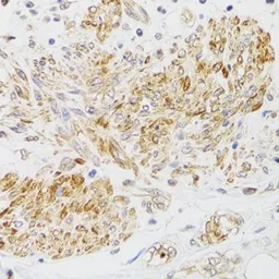 Anti-MYO5A antibody used in IHC (Paraffin sections) (IHC-P). GTX65990