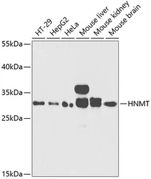Anti-HNMT antibody used in Western Blot (WB). GTX65997