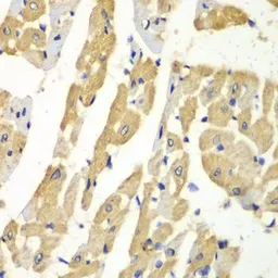 Anti-HNMT antibody used in IHC (Paraffin sections) (IHC-P). GTX65997