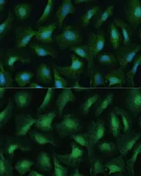 Anti-DDX3Y antibody used in Immunocytochemistry/ Immunofluorescence (ICC/IF). GTX66004