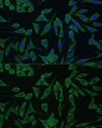 Anti-DDX3Y antibody used in Immunocytochemistry/ Immunofluorescence (ICC/IF). GTX66004