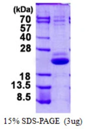 Human VPS25 protein, His tag. GTX66032-pro