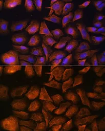 Anti-alpha Fodrin antibody used in Immunocytochemistry/ Immunofluorescence (ICC/IF). GTX66033