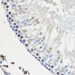 Anti-hnRNP U antibody used in IHC (Paraffin sections) (IHC-P). GTX66039