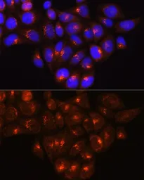 Anti-GOLGA4 antibody used in Immunocytochemistry/ Immunofluorescence (ICC/IF). GTX66053