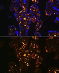Anti-ApoER2 antibody used in IHC (Paraffin sections) (IHC-P). GTX66061