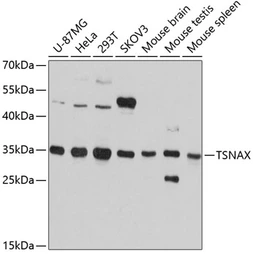 Anti-TRAX antibody used in Western Blot (WB). GTX66095