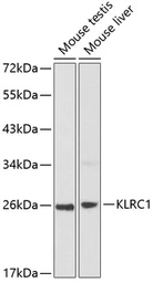 Anti-NKG2A antibody used in Western Blot (WB). GTX66098