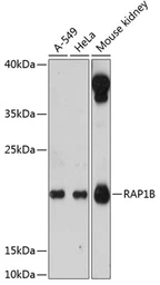 Anti-RAP1B antibody used in Western Blot (WB). GTX66139