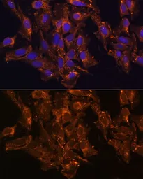 Anti-HSD17B8 antibody used in Immunocytochemistry/ Immunofluorescence (ICC/IF). GTX66143