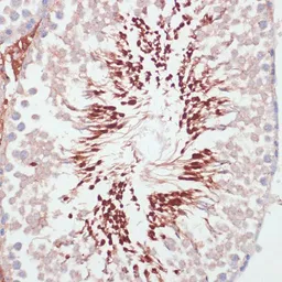 Anti-PGK2 antibody used in IHC (Paraffin sections) (IHC-P). GTX66145