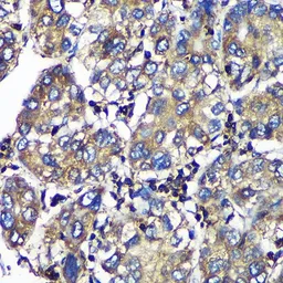 Anti-SENP1 antibody used in IHC (Paraffin sections) (IHC-P). GTX66159