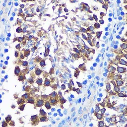 Anti-SENP1 antibody used in IHC (Paraffin sections) (IHC-P). GTX66159