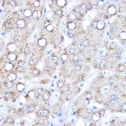 Anti-Aminoadipate aminotransferase antibody used in IHC (Paraffin sections) (IHC-P). GTX66160