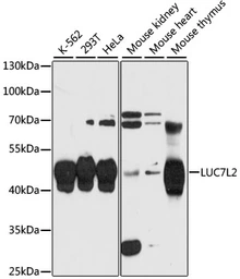 Anti-LUC7L2 antibody used in Western Blot (WB). GTX66161