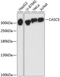 Anti-CASC5 antibody used in Western Blot (WB). GTX66163