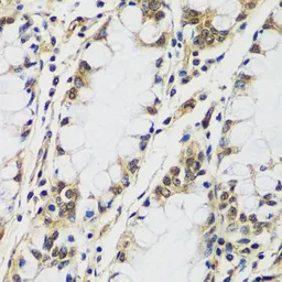Anti-CASC5 antibody used in IHC (Paraffin sections) (IHC-P). GTX66163