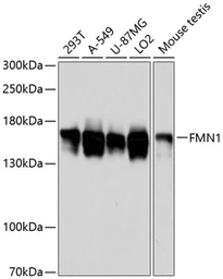 Anti-FMN1 antibody used in Western Blot (WB). GTX66171
