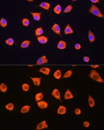 Anti-SCYL2 antibody used in Immunocytochemistry/ Immunofluorescence (ICC/IF). GTX66174