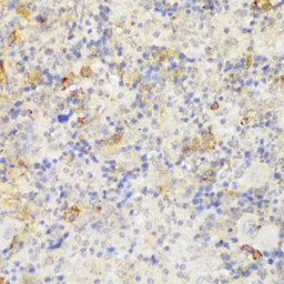 Anti-GCC2 antibody used in IHC (Paraffin sections) (IHC-P). GTX66210