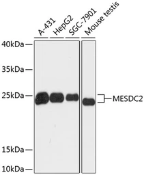 Anti-MESDC2 antibody used in Western Blot (WB). GTX66225