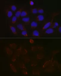 Anti-GALNT3 antibody used in Immunocytochemistry/ Immunofluorescence (ICC/IF). GTX66226