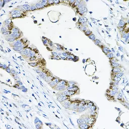 Anti-GALNT3 antibody used in IHC (Paraffin sections) (IHC-P). GTX66226