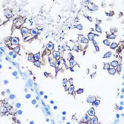 Anti-Serotonin Transporter antibody used in IHC (Paraffin sections) (IHC-P). GTX66232