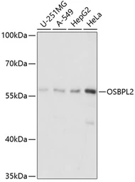 Anti-OSBPL2 antibody used in Western Blot (WB). GTX66235