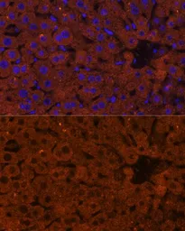 Anti-HMGCS2 antibody used in IHC (Paraffin sections) (IHC-P). GTX66240