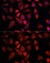 Anti-NDUFA4L2 antibody used in Immunocytochemistry/ Immunofluorescence (ICC/IF). GTX66244