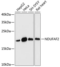 Anti-Mimitin antibody used in Western Blot (WB). GTX66245
