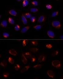 Anti-ERp19 antibody used in Immunocytochemistry/ Immunofluorescence (ICC/IF). GTX66255
