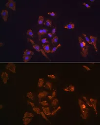 Anti-Thyrotropin releasing hormone antibody used in Immunocytochemistry/ Immunofluorescence (ICC/IF). GTX66259