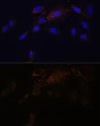 Anti-Proteasome 20S beta 7 antibody used in Immunocytochemistry/ Immunofluorescence (ICC/IF). GTX66287