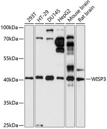 Anti-WISP3 antibody used in Western Blot (WB). GTX66293
