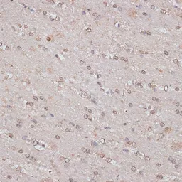 Anti-TLK1 antibody used in IHC (Paraffin sections) (IHC-P). GTX66297