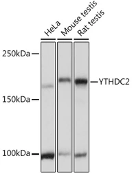 Anti-YTHDC2 antibody used in Western Blot (WB). GTX66320
