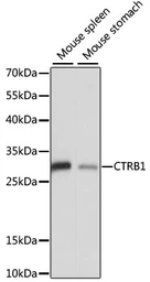Anti-CTRB1 antibody used in Western Blot (WB). GTX66324