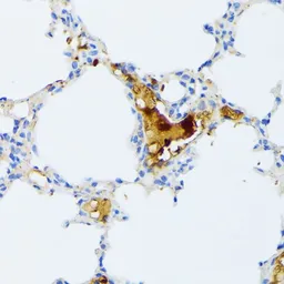 Anti-CTRB1 antibody used in IHC (Paraffin sections) (IHC-P). GTX66324