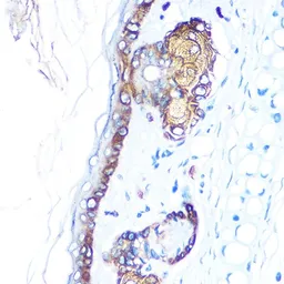 Anti-Cytokeratin 14 antibody used in IHC (Paraffin sections) (IHC-P). GTX66326