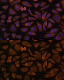 Anti-RABIF antibody used in Immunocytochemistry/ Immunofluorescence (ICC/IF). GTX66331