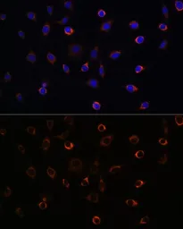 Anti-KIF5B antibody used in Immunocytochemistry/ Immunofluorescence (ICC/IF). GTX66352