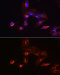 Anti-KIF5B antibody used in Immunocytochemistry/ Immunofluorescence (ICC/IF). GTX66352
