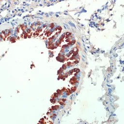 Anti-KIF5B antibody used in IHC (Paraffin sections) (IHC-P). GTX66352